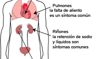 Hipertensión Pulmonar: Causas, Síntomas, Diagnóstico, Tratamiento