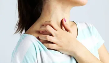Cómo tratar la alergia a la joyería de fantasía