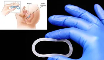Crean un anillo vaginal que protege del VIH y del herpes