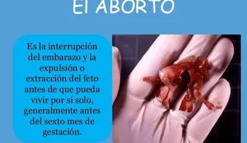  La ONU pide a R.Dominicana que despenalice el aborto en algunos supuestos 