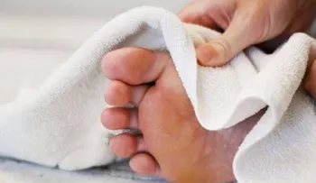 ¿Cómo prevenir los hongos en las uñas?