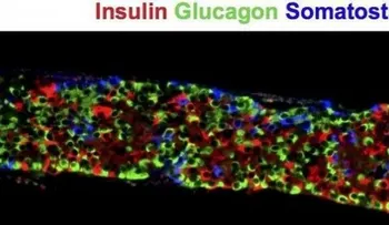 Trasplante de células madre, el futuro para curar y tratar la diabetes