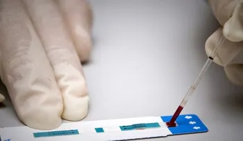 Será indemnizado con 40 mil dólares, un chileno que supo que tenía VIH 3 años después de prueba 