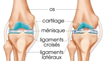 Células madre para curar la artrosis de rodilla