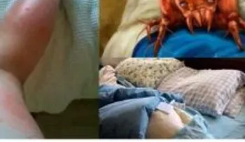 Con solo hacer esto, puede eliminar más de un millón de ácaros de tu cama