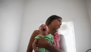 640 casos de microcefalia confirmados en Brasil