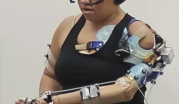 Diseñan un brazo biónico para personas con amputaciones de miembros 