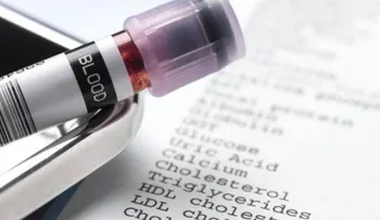 El test que predice si vas a morir en los próximos cinco años