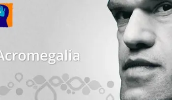 La movilidad en pacientes con acromegalia puede verse afectada