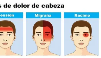 Lo que los dolores de cabeza revelan sobre tu salud