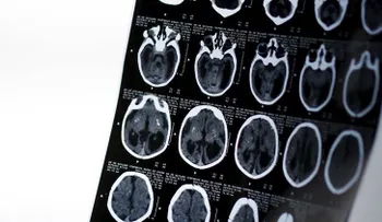 ¿Cómo destruimos nuestro cerebro a diario sin saberlo?