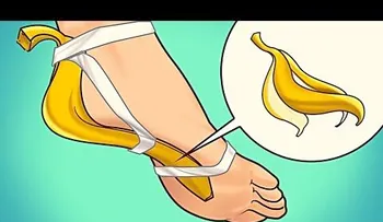 Una cáscara de plátano funciona de manera mágica