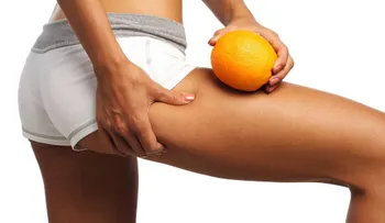 Cómo prevenir la celulitis y reducir sus efectos
