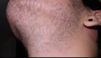 ¿Como hacer crecer la barba?