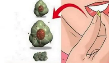 El cáncer muere cuando se comen estos 7 alimentos, empieza de inmediato!!