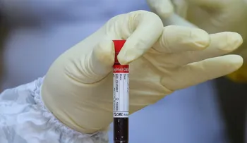 Sangre tipo O podría ofrecer cierta protección contra la infección por COVID-19