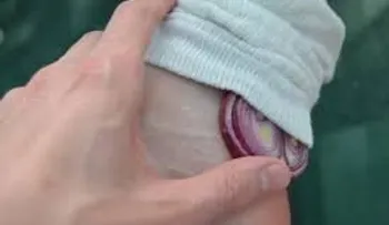 Lo hice por mi propia cuenta y descubrí los milagrosos beneficios de dormir con una cebolla en mis pies cada noche