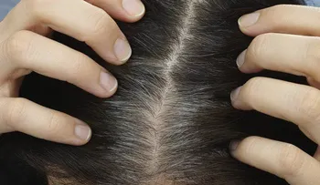 Aceite de coco y limón para normalizar el color natural de pelo