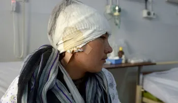 La entregaron en matrimonio a los 13 años y el marido le cortó las orejas por mirar a otros hombres