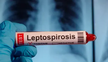 Casos de leptospirosis aumentan 154% en RD; muertes suben a 19