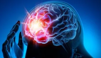 7 tips para prevenir un aneurisma