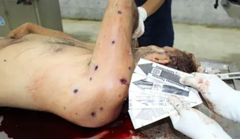 Advertencia de imágenes sensibles  cadáver de Óscar Pérez, alegadamente ejecutado tras sublevarse contra Maduro