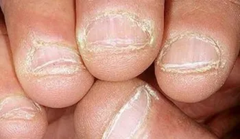 11 razones para nunca más te muerda las uñas