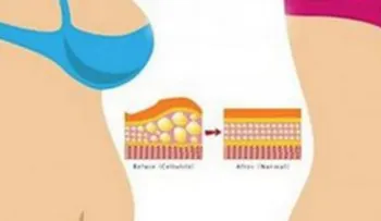 Con esta bebida eliminas toda la grasa del abdomen y mira por qué?