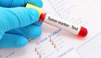 Desarrollan un examen de sangre que revela ocho tipos de cáncer