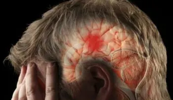 Mira los síntomas de derrame cerebral que quizás no conocías