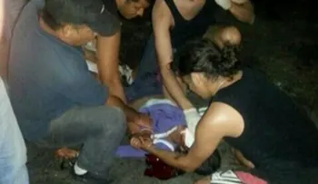 GNB dispara en la cara a estudiante en Naguanagua