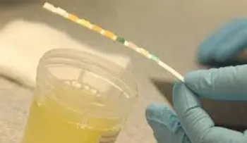Un color turbio en la orina puede ser síntoma de una infección