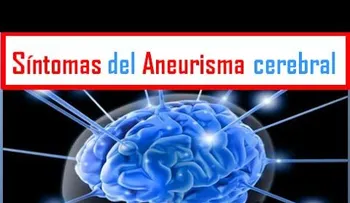 Que es una aneurisma, causa y consecuencia (VIDEO)