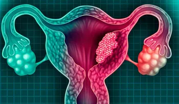 El cáncer de cuello uterino afecta más a mujeres entre los 35 y 44 años