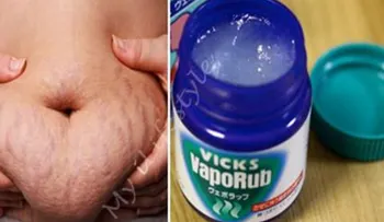 13 usos del VICKS VAPORUB que nadie te había dicho. Esto es increíble, porque no lo habían dicho antes
