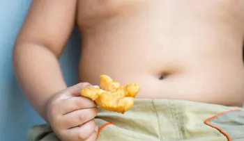 Presentan plan para disminuir obesidad en población infantil del país 
