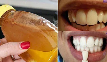 Haga gárgaras con un simple ingrediente y sucederá algo increíble en tus dientes