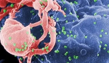 Las tijeras celulares que evitan lnfección por el virus del sida