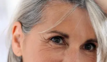 Remedio con cáscara de papa para oscurecer las canas