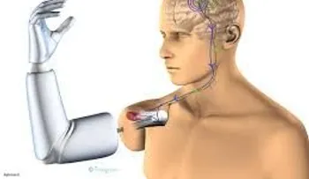 Utilizan novedosa tecnología para prótesis de rodilla en RD