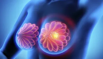 Advierten sobre la estrecha relación entre el cáncer de mama y de ovarios