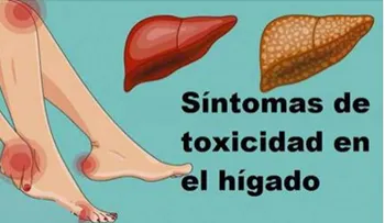 16 señales de que tu Hígado no está funcionando bien y las toxinas se están acumulando en tu cuerpo