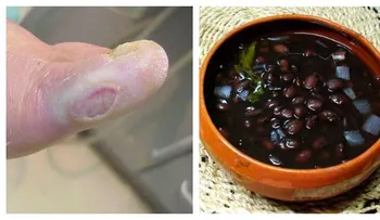 Conoce la antigua manera de tratar la DIABETES que los médicos constantemente ignoranâ?¦.