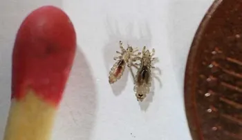 Acaba con los piojos de la cabeza usando este remedio seguro y natural! Pruébalo ya!