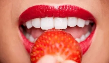 Consejos para mantener la blancura de tus dientes