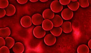 Logran erradicar el VIH por medio de un tratamiento experimental