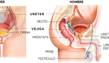 Estrechez uretral: cómo afecta la calidad de vida y por qué es clave el diagnóstico oportuno