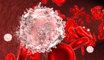  Descifran cómo funciona el genoma de la leucemia más frecuente 