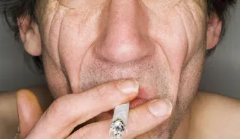 El rostro del fumador y sus daños muy notorios en la piel