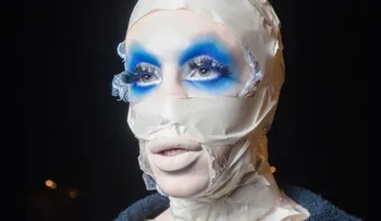 El increíble rostro de Vinny Ohh luego de 110 cirugías para convertirse en un "marciano asexuado"
